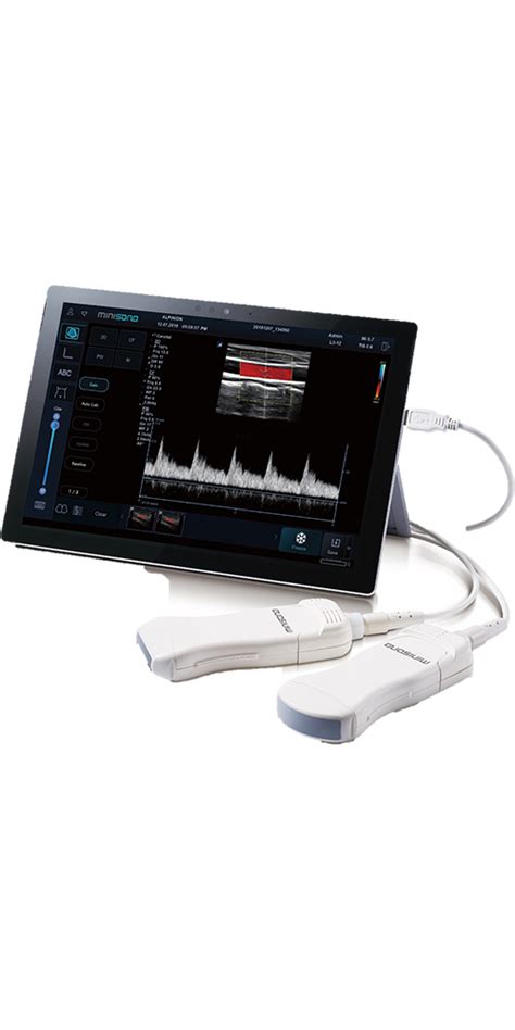 Used Ultrasound Machine Musculoskeletal Informacionpublica Svet Gob Gt