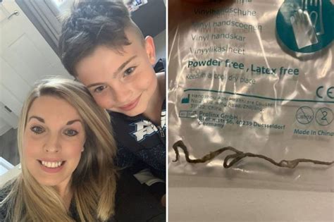 Mum Mortified After ‘brain Eating Worm In Her Eight Year Old Sons Ear