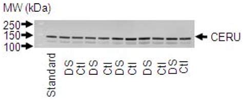 Representative 1d Western Blot For Anti Ceruloplasmin Expression Download Scientific Diagram