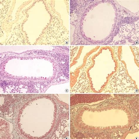 Histological Analysis Of Lung Sections At Weeks After Systemic