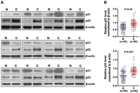 P53 And P21 Protein Expression In Nsclc Patient Tissues A Western Download Scientific