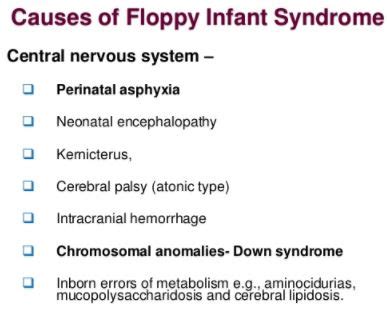 Floppy Baby Syndrome Causes Treatment Symptoms Pictures Prognosis