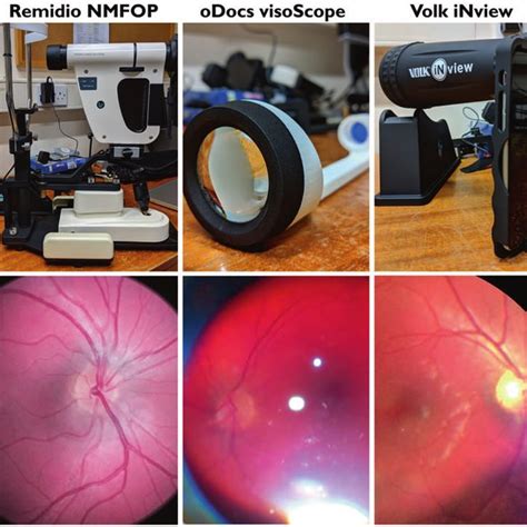 Overview Of Table Mounted And Handheld Fundus Cameras And Fundus