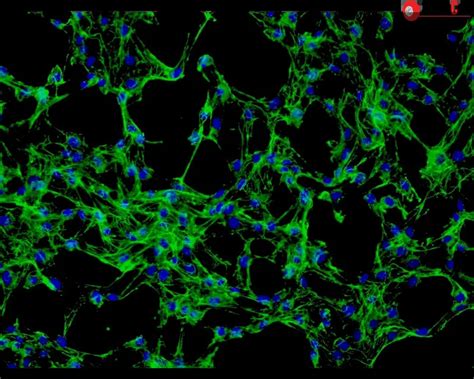 Human Dermal Fibroblasts Adult Hdf A