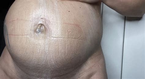 Free Mature Belly Porn Videos Xhamster