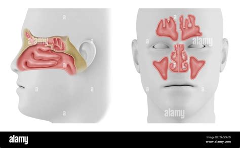 Anatomy Paranasal Sinuses Side Views Frontal Sinus Maxillary Sinus