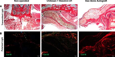 Histological Sections Of Picrosirius Red Staining Of The Non Operated Download Scientific