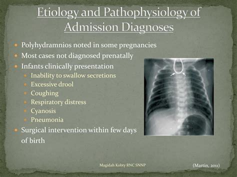 Ppt Tracheoesophageal Fistula With Esophageal Atresia Clinical Case