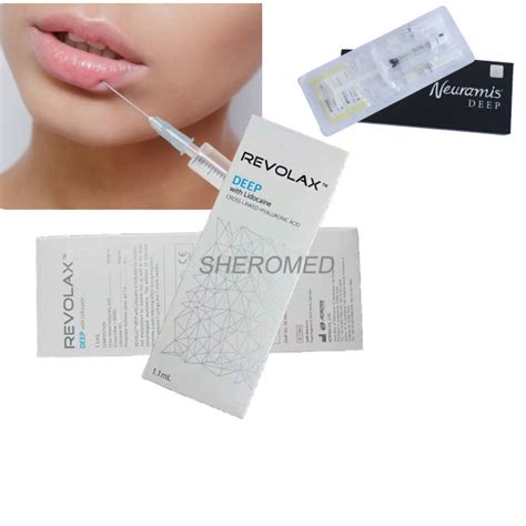 Revolax Neuramis Hyaluronic Acid Dermal Filler Marionette Lines Lip