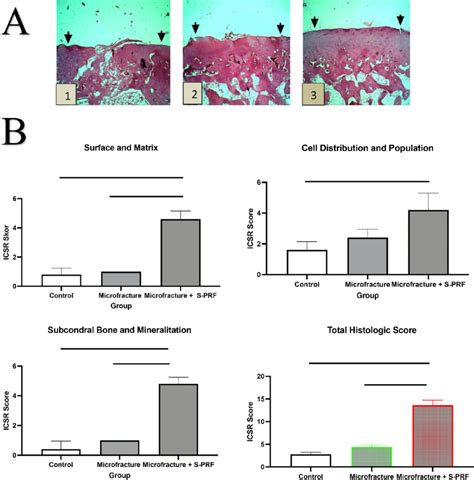 A Histological Evaluation Results On Cartilage Healing Tissue 1