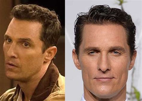 Matthew McConaughey Hair Loss Secrets Revealed!