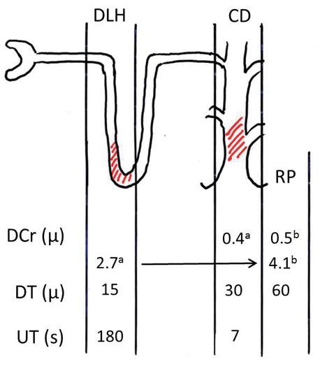 The Way from Renal Calcifications and Urinary Crystals to Kidney Stones ...