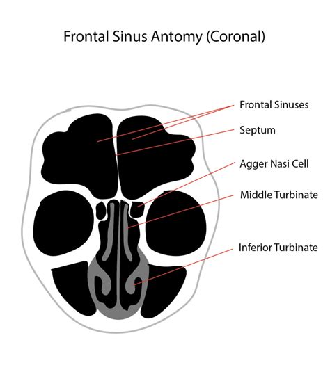 Figure Diagram Of The Frontal Sinus Anatomy Coronal View