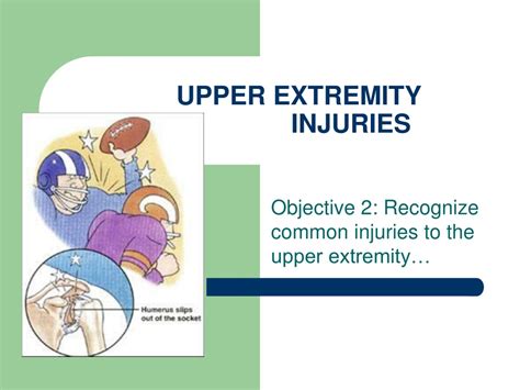 upper extremity injuries powerpoint    id