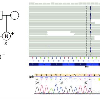 The titin (TTN) gene mutation in the proband; left: Pedigree of the... | Download Scientific Diagram