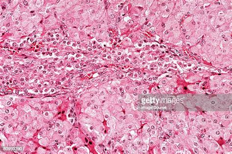 Ovary Cells Photos And Premium High Res Pictures Getty Images