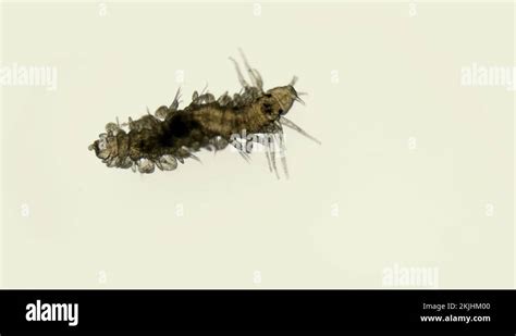 Worm Larva At Nektoheta Stage Under A Microscope Class Polychaeta Stock Video Footage Alamy