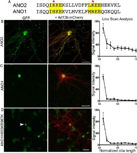 SUMOylation Sites Are Not Sufficient For Localization Of ANO1 To