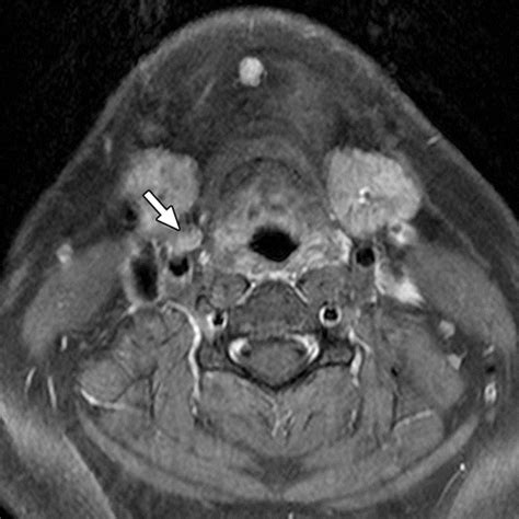 How To Perform Parathyroid D Ct Tips And Traps For Technique And