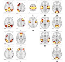 HOW MANY FMRI SCANS ARE NECESSARY AND SUFFICIENT FOR RESTING BRAIN ...