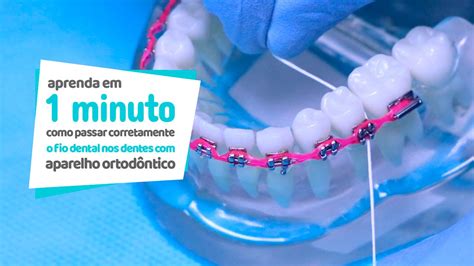 Fio Dental Para Dentes Muito Juntos - Melhor Fio Dental Para Dentes Juntos - RETOEDU