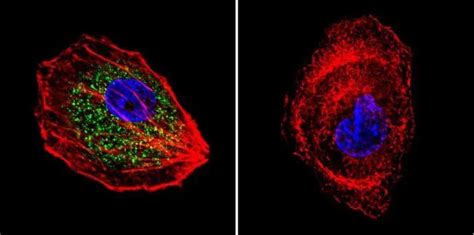 Anti Cdc42 Antibody Gtx54514 Genetex