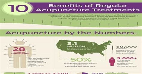 Benefits Of Regular Acupuncture Treatments Infographic Infographics