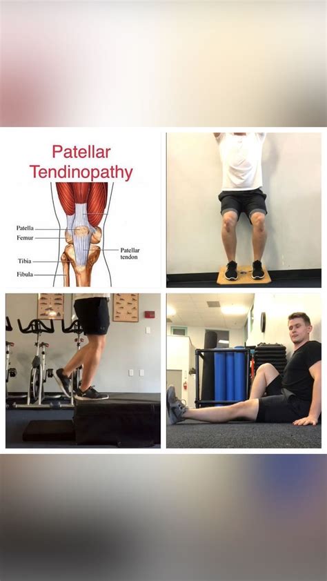 Patellar Tendinopathy An Immersive Guide By Schaefit