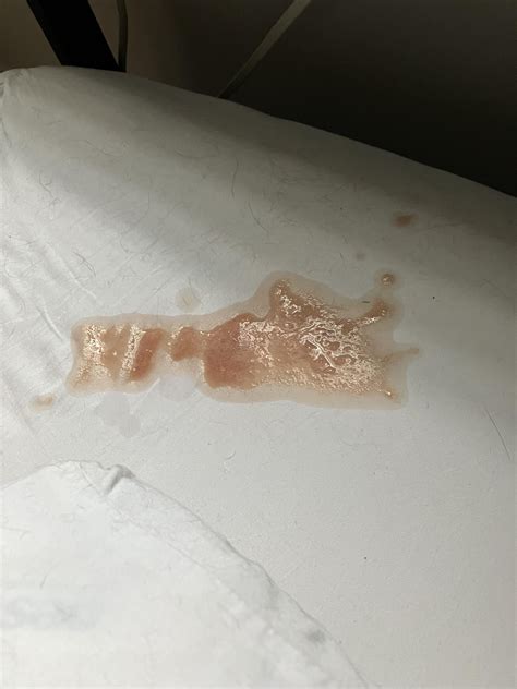 My cat has been vomiting blood since yesterday. I took him to ER, and