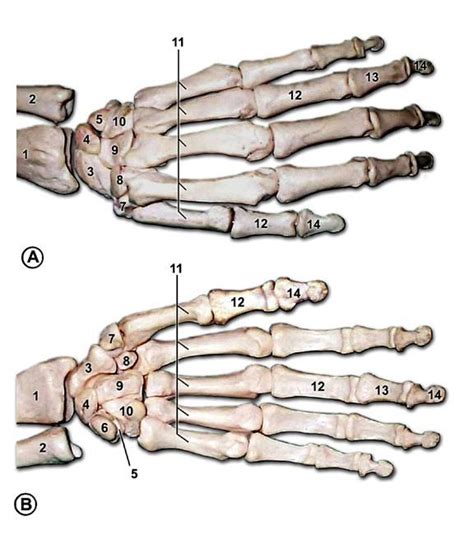 Bones of the left hand. A is the back of the hand, B is the palm. How many do you count total ...