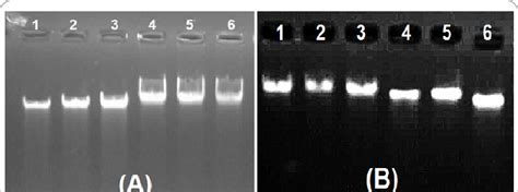 Agarose Gel Electrophoresis 1 Of Genomic Dna From Four Methods Of Download Scientific