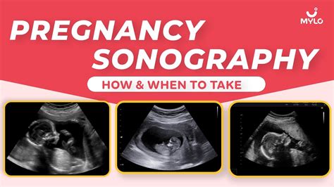 Sonography During Pregnancy What Is Sonography In Pregnancy In Hindi