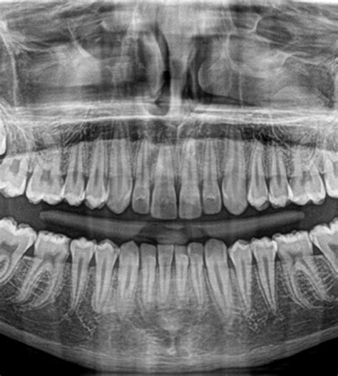 Exames Imagem Radiologia