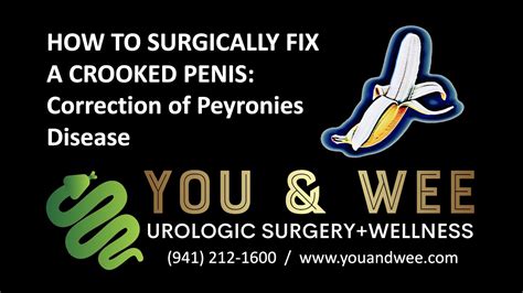 How To Surgically Fix A Crooked Penis Correction Of Peyronies Disease