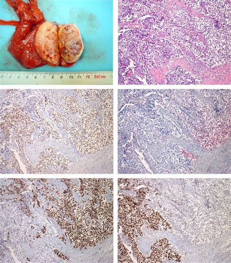 Embryonal Carcinoma Cells