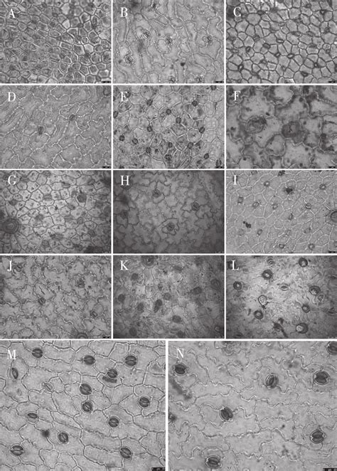 Light Microscope Photographs Of Epidermal Cells In Oxytropis Dc A B