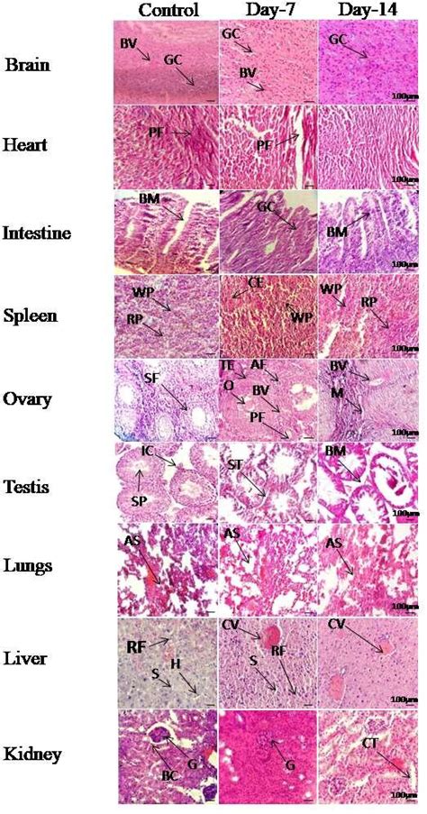 Histology of Brain. GC = Glial cells, BV = Blood vessel. Histology of ...