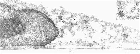 Transmission Electron Micrograph Cultured Bovine Umbilical Vein