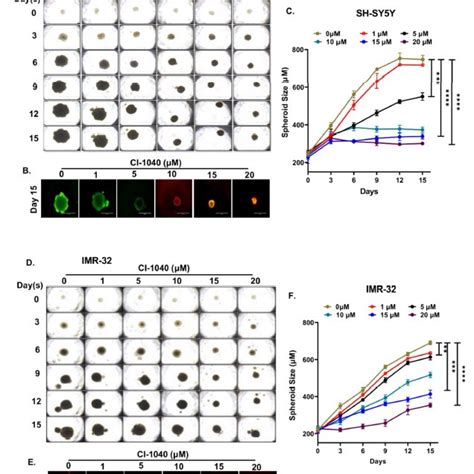 CI 1040 Inhibits NB 3D Spheroid Tumor Growth NB 3D Spheroids Of MYCN