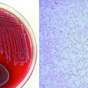 A Nonhemolytic Smooth Colonies On Blood Agar B Gram S Stain Of The