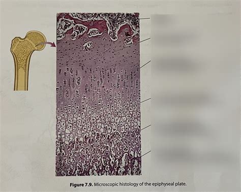 Epiphyseal Plate Diagram Quizlet