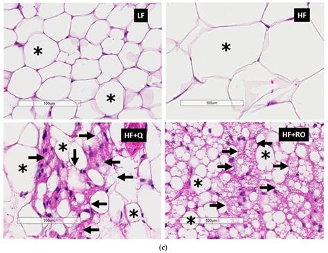 Ijms Free Full Text Dietary Quercetin Attenuates Adipose Tissue