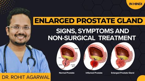 Enlarged Prostate Gland Or Benign Prostatic Hyperplasia Symptoms And