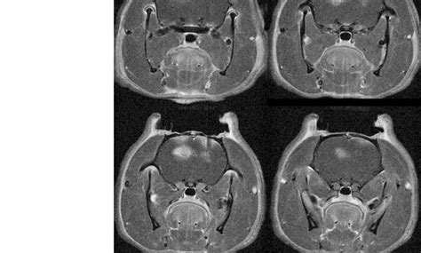 T1w Gadolinium Mri Of A Rat Brain With Catheters In U87 Tumor Left