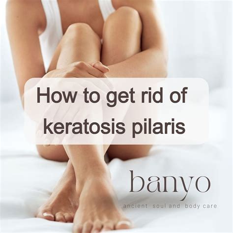 How To Get Rid Of Keratosis Pilaris