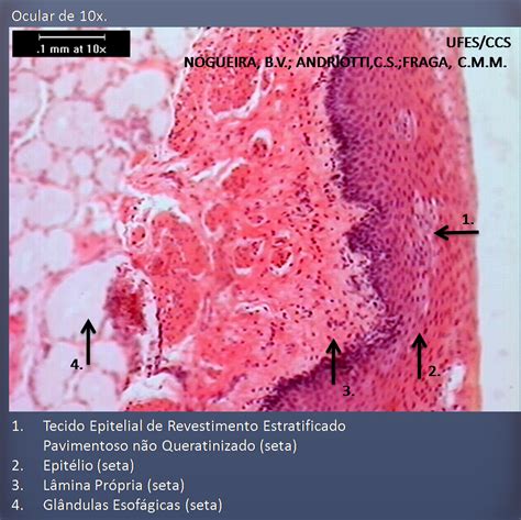 Cerebelo Histologia