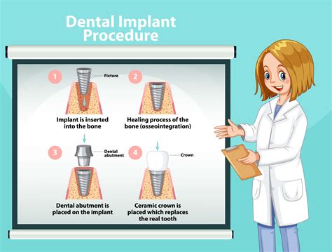 Get Dental Implants in 4 easy steps at Holistic Smile Care - West ...