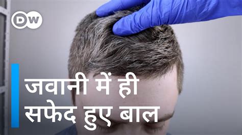 बालों में सफेदी क्यों आती है [what Causes Greying Of Hair] Youtube