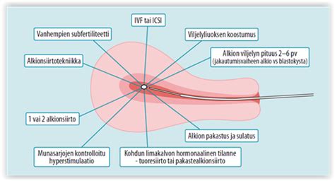 Esitell Imagen Itsen Isyysmaraton Tulokset Abzlocal Fi