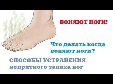 Воняют ноги // Что делать если воняют ноги // Как избавиться от запаха ...